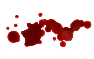 Women under anticoagulant treatment due to VTE have more bleedings than men