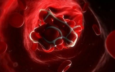 Un tercio de los pacientes anticoagulados, mal controlado