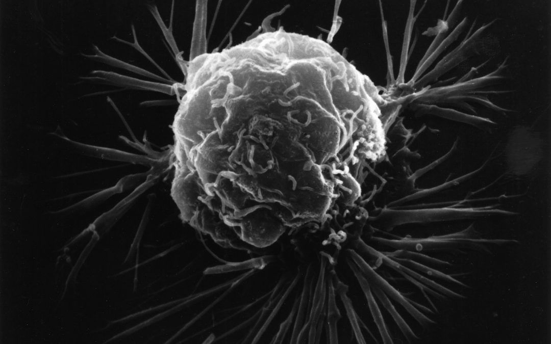 Response to anticoagulant therapy in patients with cancer depends on the tumor
