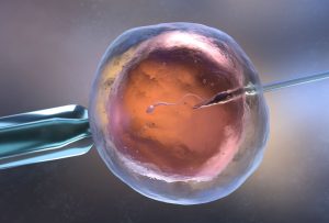 in vitro fertilization