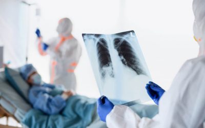 Covid-19 + embolia pulmonar en el hospital = peores resultados