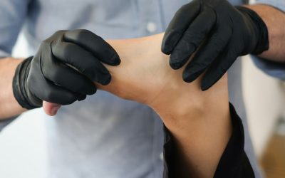 El esguince de tobillo también precisa tromboprofilaxis