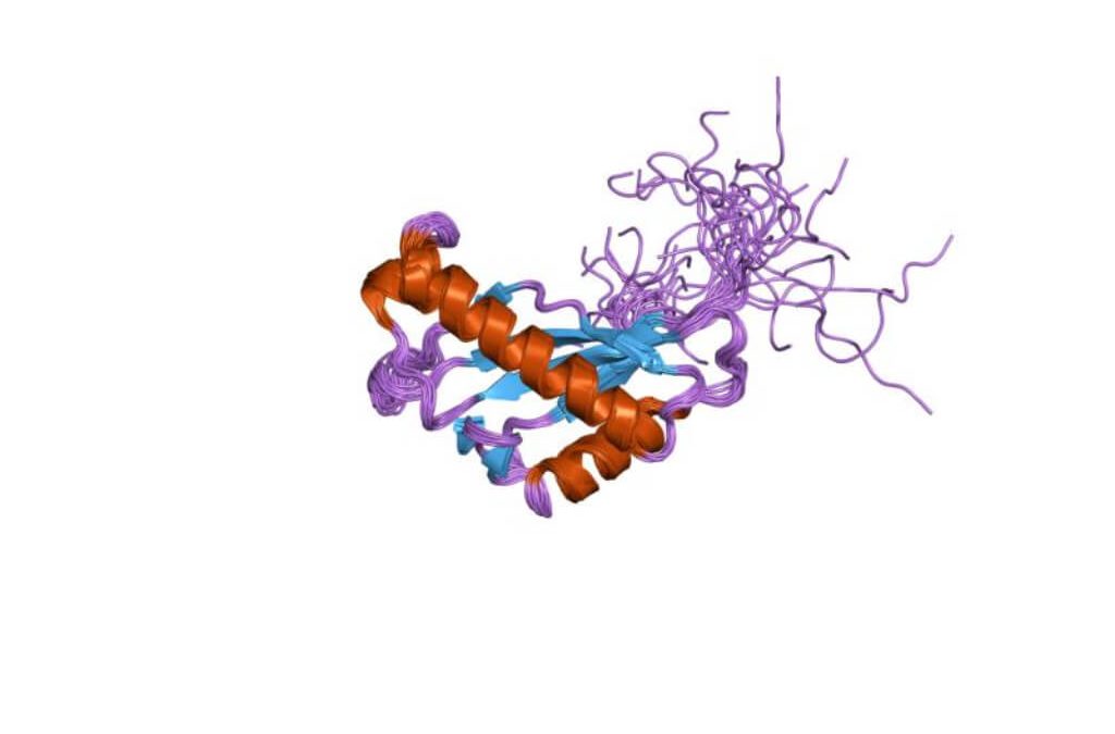 La proteína CA-125, biomarcador para conocer el riesgo de muerte en casos de embolia pulmonar