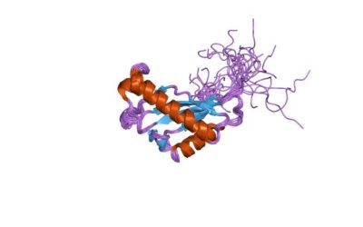 La proteína CA-125, biomarcador para conocer el riesgo de muerte en casos de embolia pulmonar