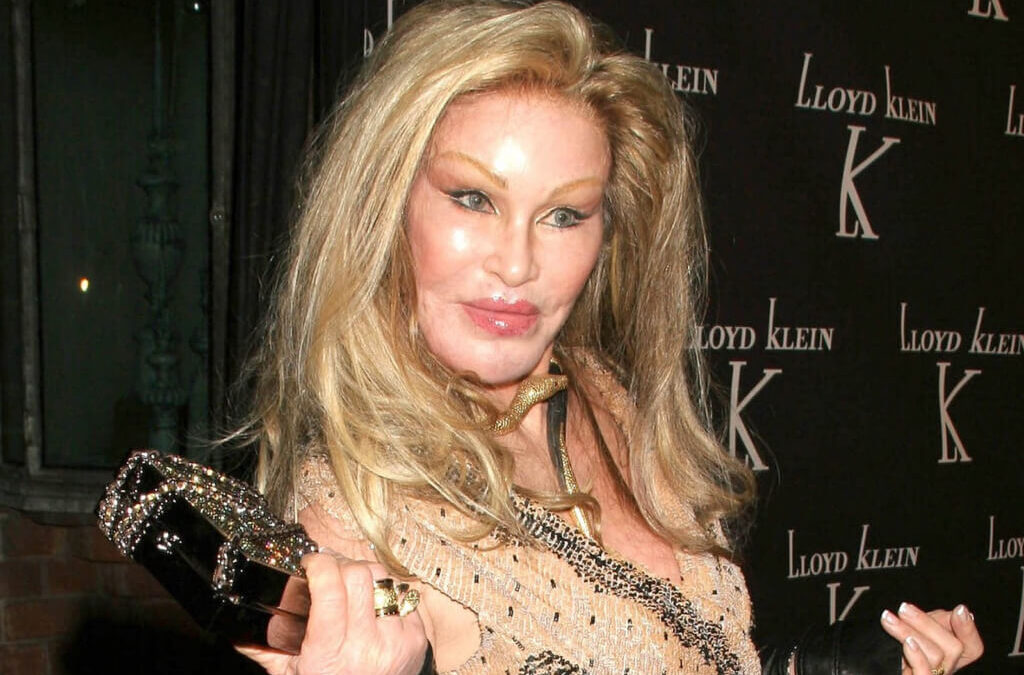 Jocelyne Wildenstein, ‘Catwoman’, fallece por una embolia pulmonar