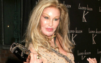 Jocelyne Wildenstein, ‘Catwoman’, fallece por una embolia pulmonar