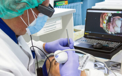 Ante una cirugía dental, mejor interrumpir el tratamiento con anticoagulantes orales de acción directa